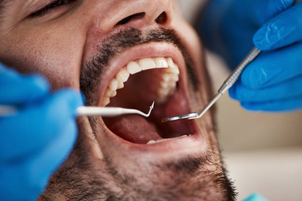 Best Emergency Dental Services for Seniors in South Coventry, CT
